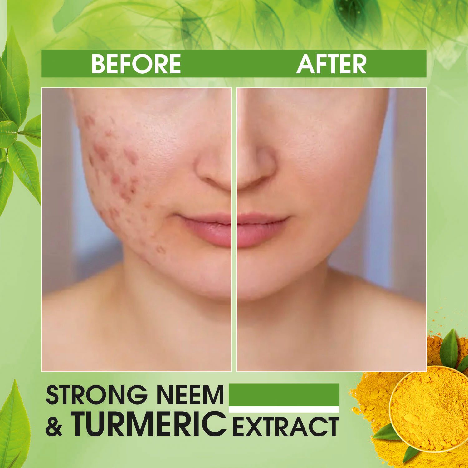 Anti Acne Face Wash 2